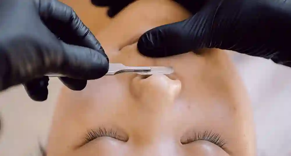 Techniques of Dermaplaning